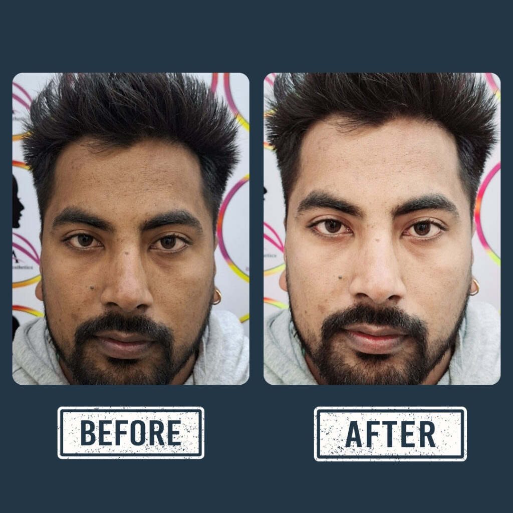 gagan3 (1).psd (43)