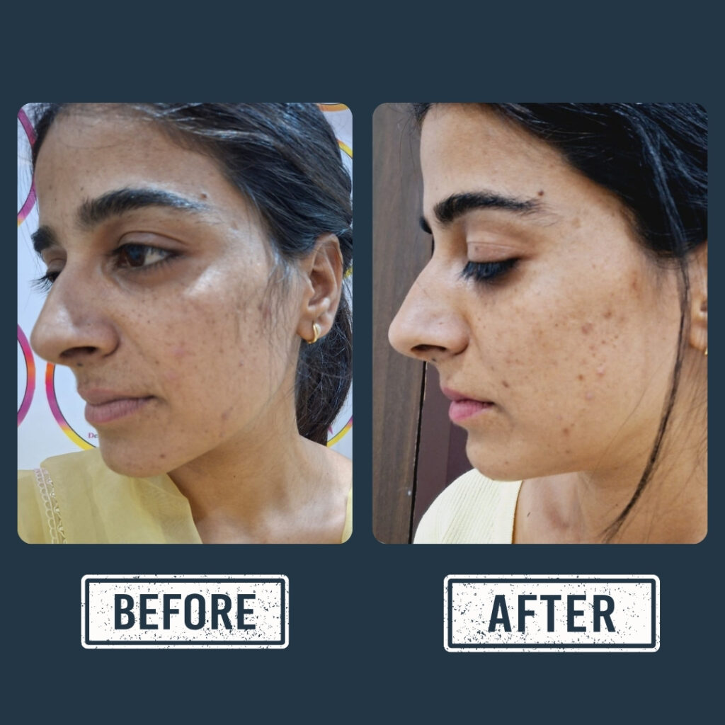 gagan3 (1).psd (44)