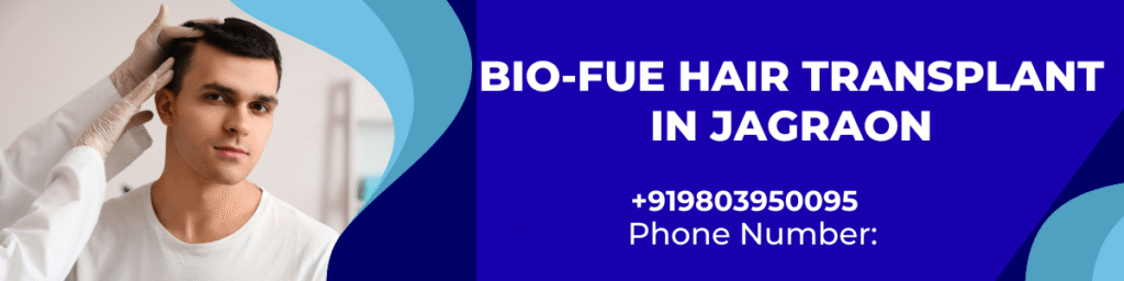 Bio-FUE Hair Transplant in Jagraon – Derma Shine Aesthetics